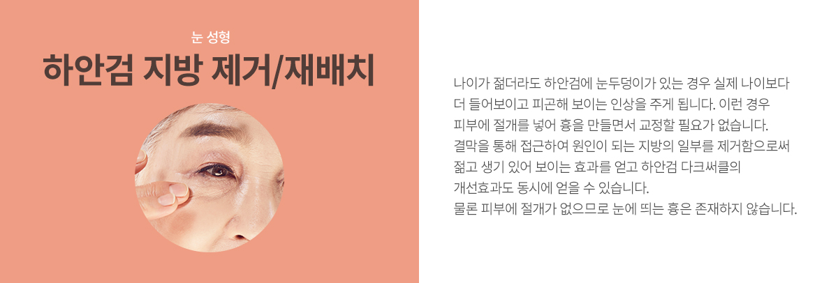 ��������/�������ġ