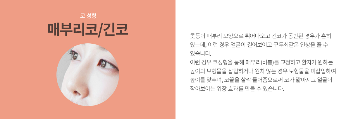 �źθ���/���� ����