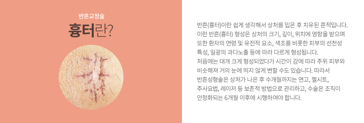 ���米����