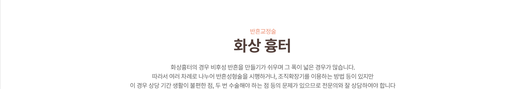 ���米����