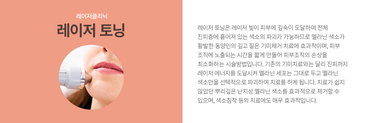 ���� �Ǻ���(���)