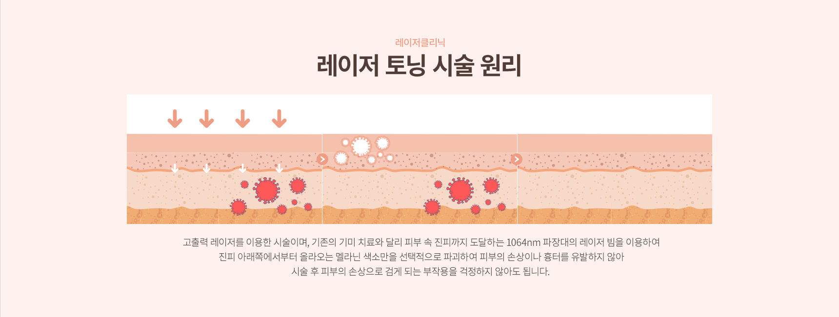 ���� �Ǻ���(���)